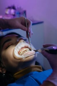 Real Stories of Teeth Straightening in Bradford11