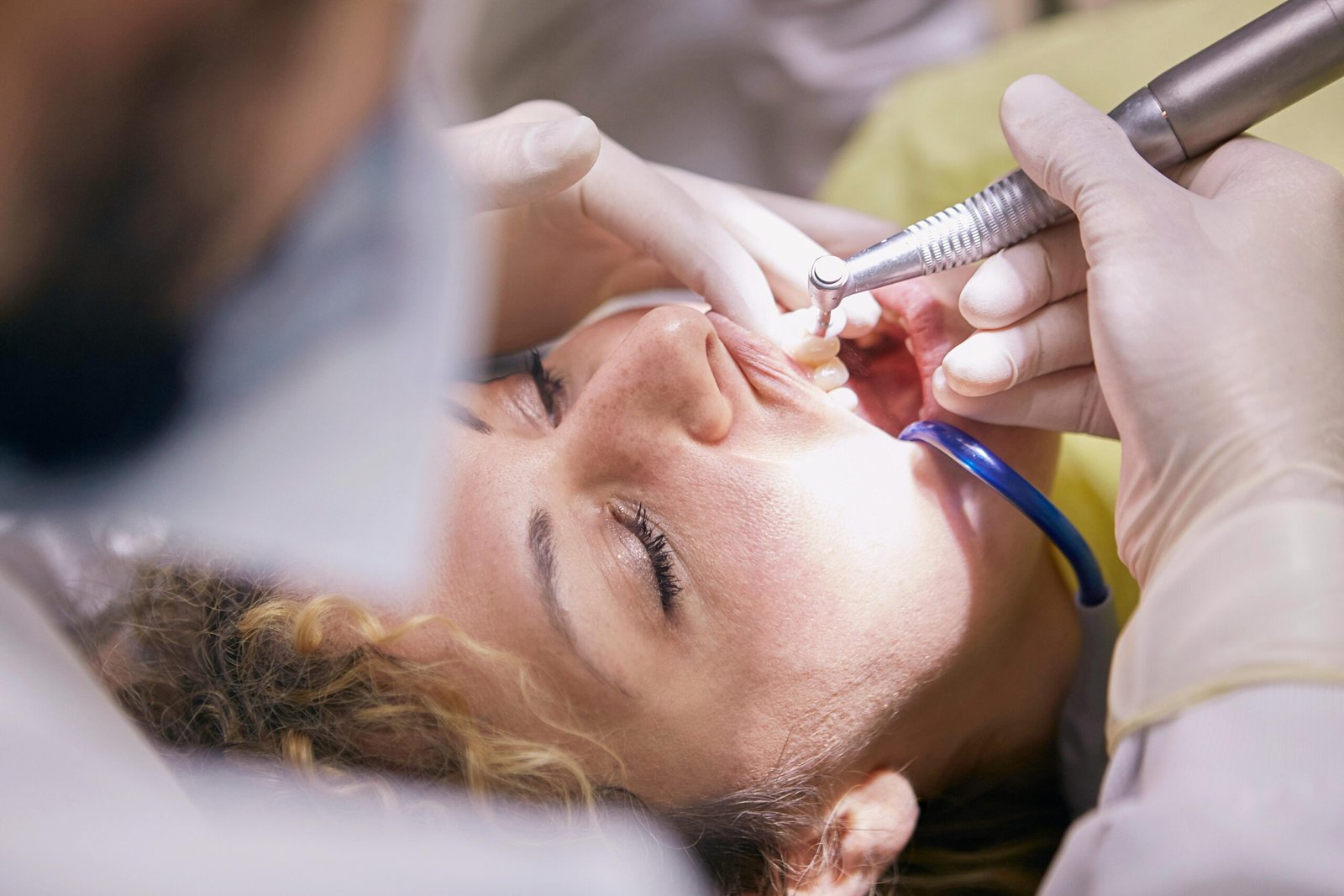 Dental Fillings in Bradford: Signs, Process, Types & Aftercare