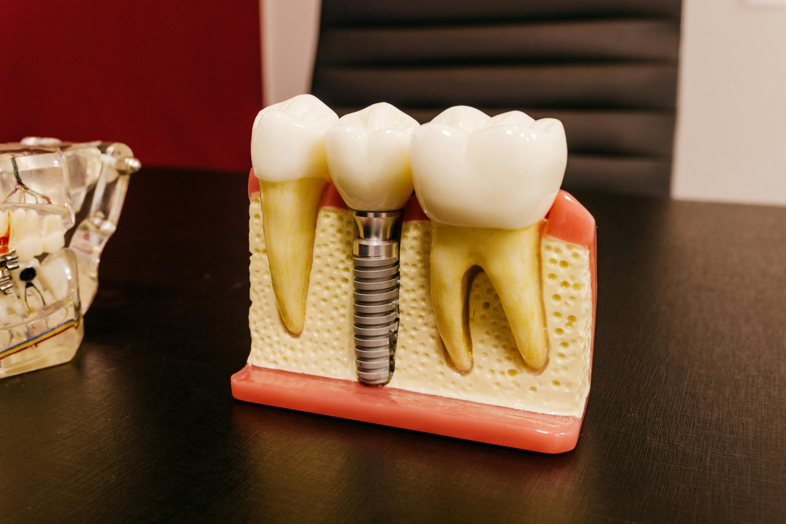 Choosing the Right Root Canal Specialist in Bradford