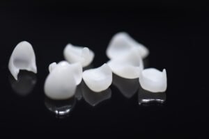 Affordable Dental Veneers in Bradford 34