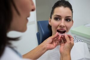 Invisalign Braces