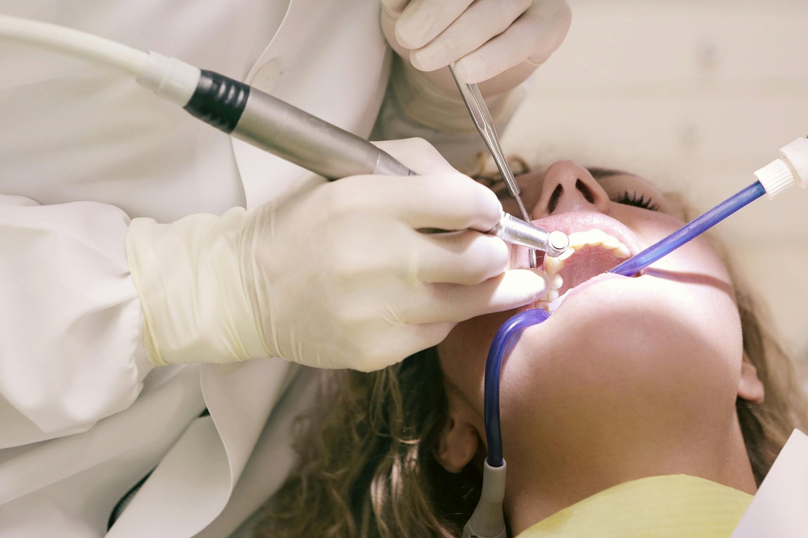 Signs you need a root canal